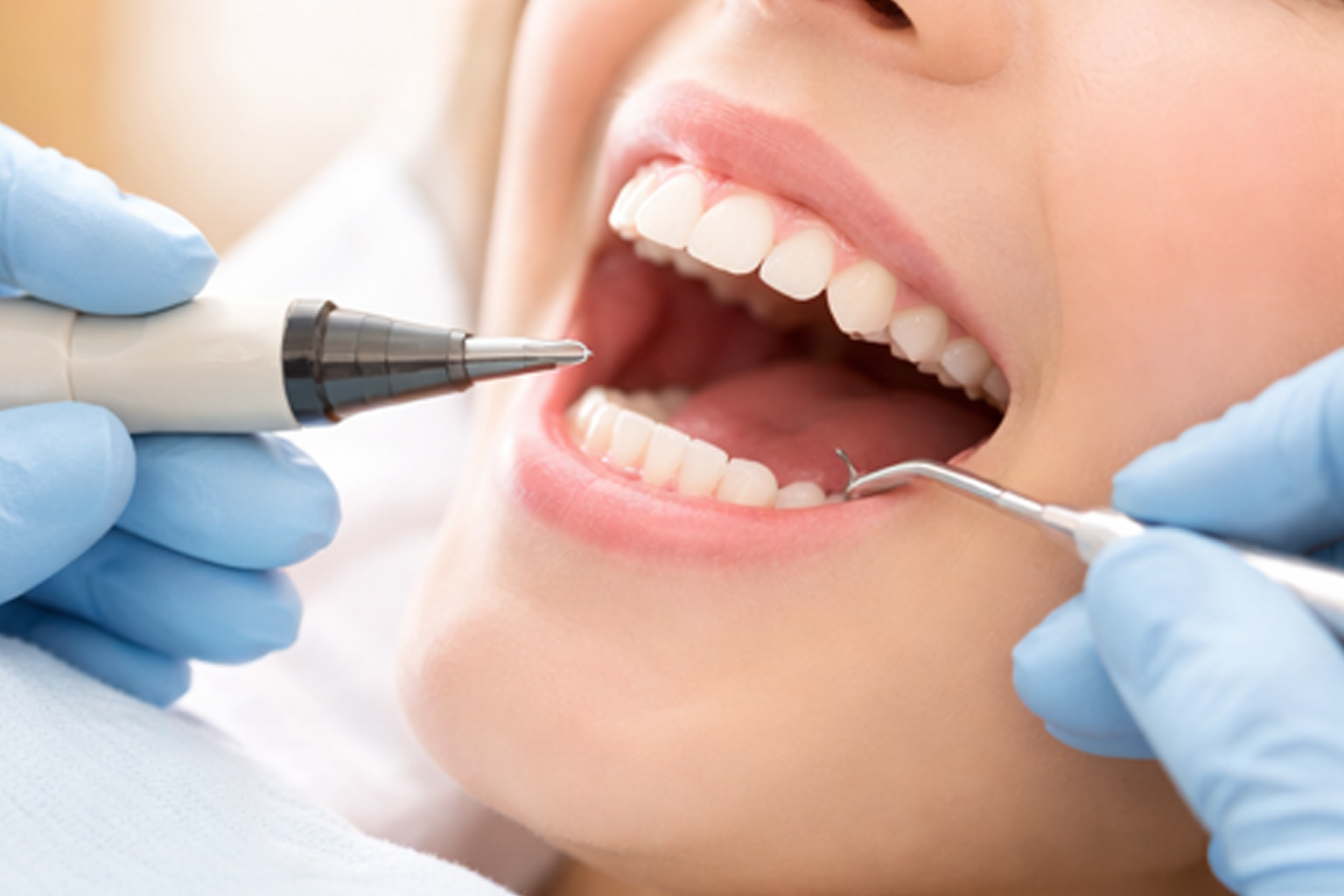 一般歯科の写真